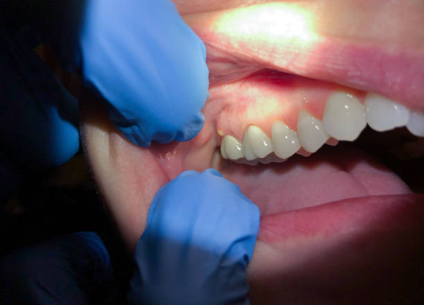 Best Emergency TMJ Treatment in Florida, NY